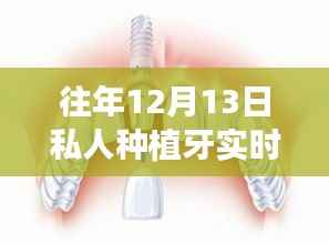 历年12月13日私人种植牙实时价格表,种植希望之芽背后的励志故事与价格变化学习笔记
