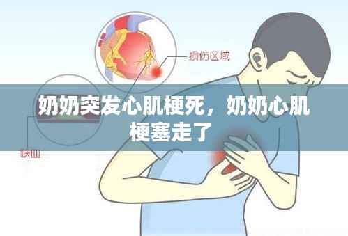 奶奶突发心肌梗死,奶奶心肌梗塞走了