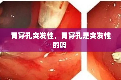 胃穿孔突发性,胃穿孔是突发性的吗